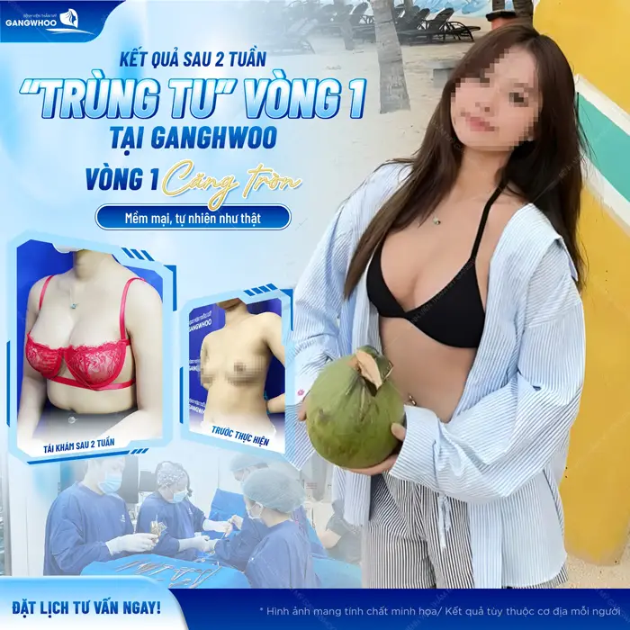 Kết quả sau 2 tuần trùng tu vòng 1 tại Gangwhoo vòng 1 đẹp căng tròn mềm mại, tự nhiên như thật