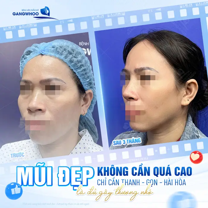 Mũi đẹp không cần cao quá chỉ cần thanh thoát hài hòa vẫn toát lên được vẻ đẹp đầy thương nhớ