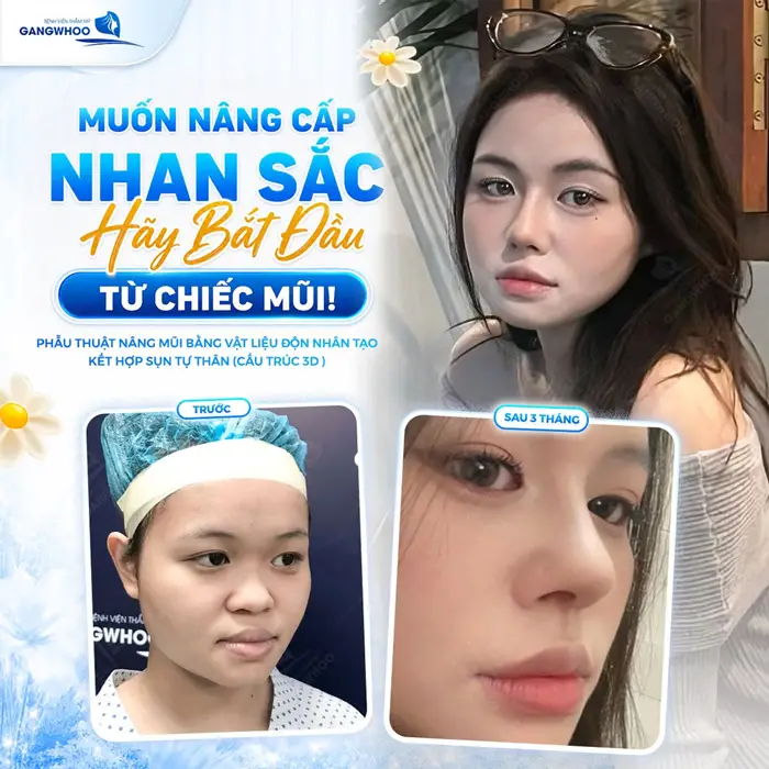 Nhan sắc lên hương diện mạo thêm cuốn hút và bừng sức sống chỉ với 1 sự thay đổi bắt đầu từ chiếc mũi