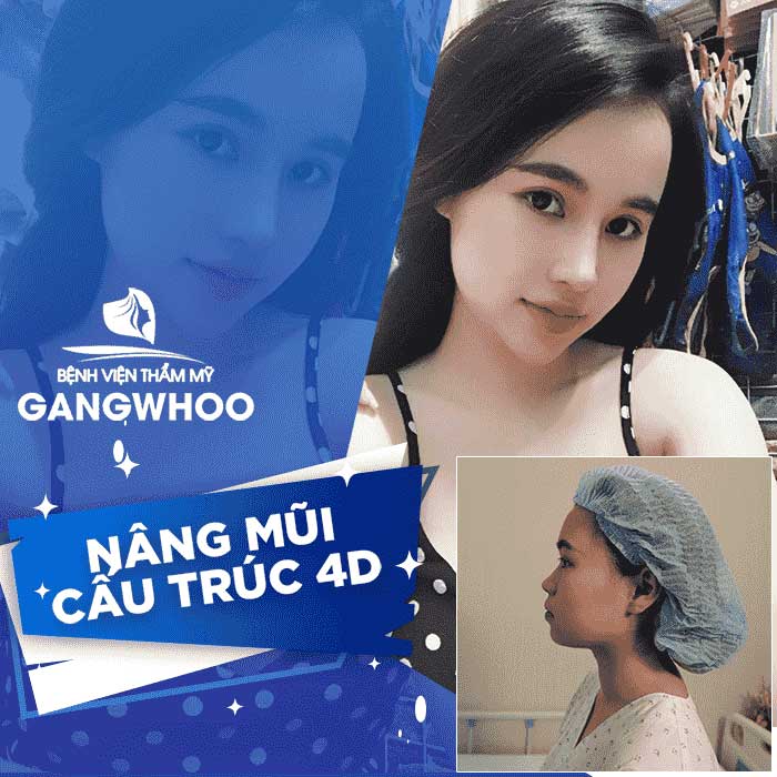 Images of our customers before & after autologous cartilage rhinoplasty at Gangwhoo Cosmetic Hospital