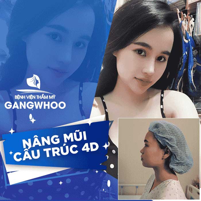 nang mui cau truc bvtm gangwhoo 2