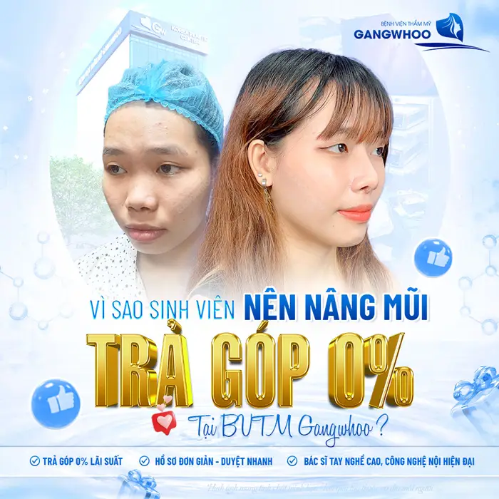 Nâng Mũi Trả Góp 0% - Nâng Mũi Đẹp Chẳng Lo Giá