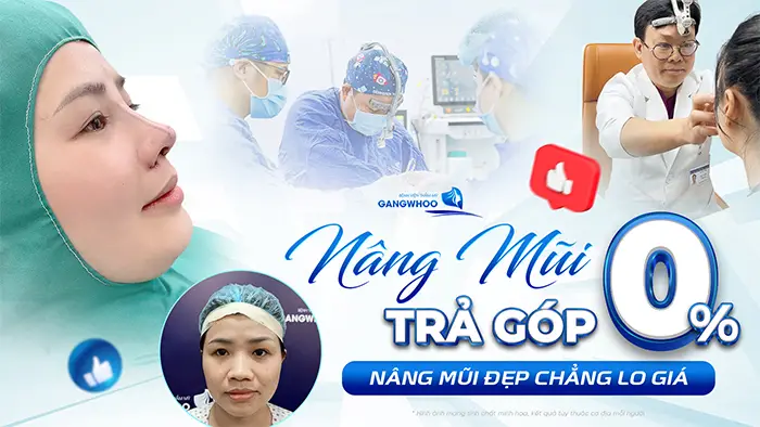 nang mui tra gop
