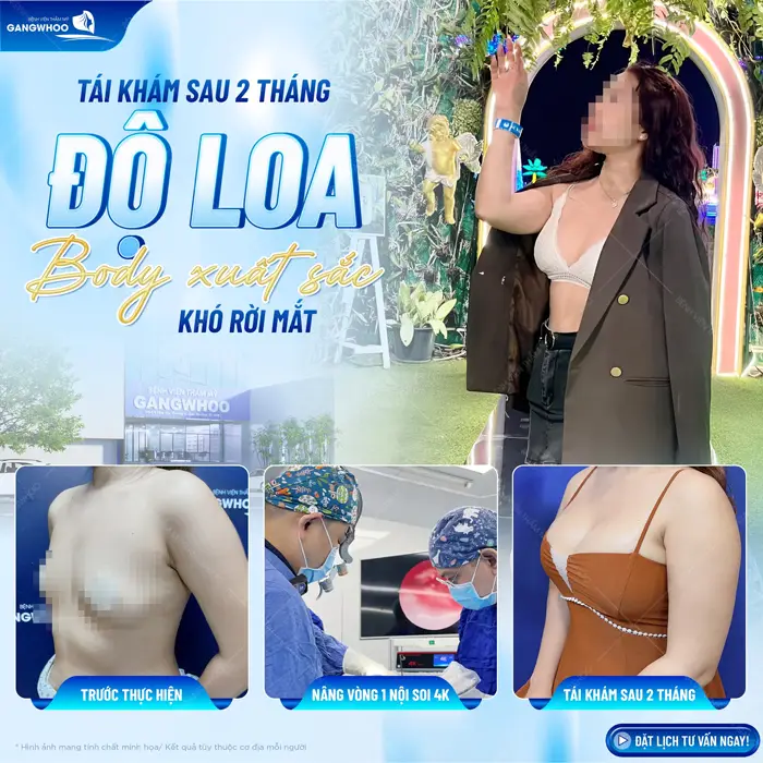 Tái khám sau 2 tháng độ loa body đẹp xuất sắc đến khó rời mắt 