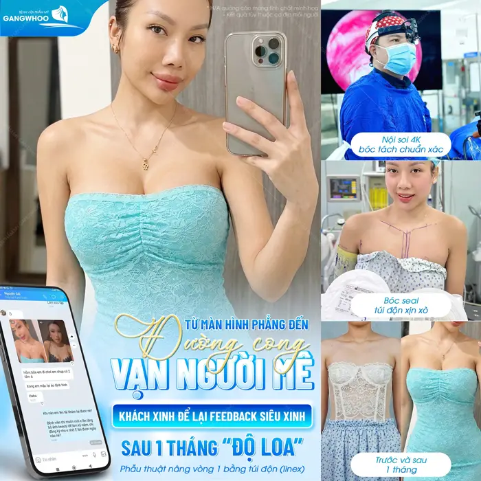 Sau Nâng Ngực Nghỉ Dưỡng Bao Lâu? 5 Yếu Tố Ảnh Hưởng 1 Từ màn hình phẳng đến đường cong vạn người mê khách hàng tự tin hơn sau nâng cấp vòng 1 ứng dụng công nghệ hiện đại