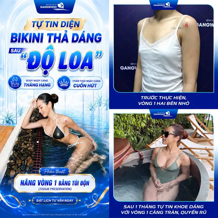 Tự tin diện Bikini thả dáng sau "trùng tu" vòng 1 tôn lên đường cong sexy cho cơ thể