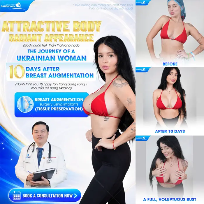 Body cuốn hút thần thái rạng ngờ hành trình sau 10 ngày tân trang vòng 1 cho khách hàng đến tù Ukraina
