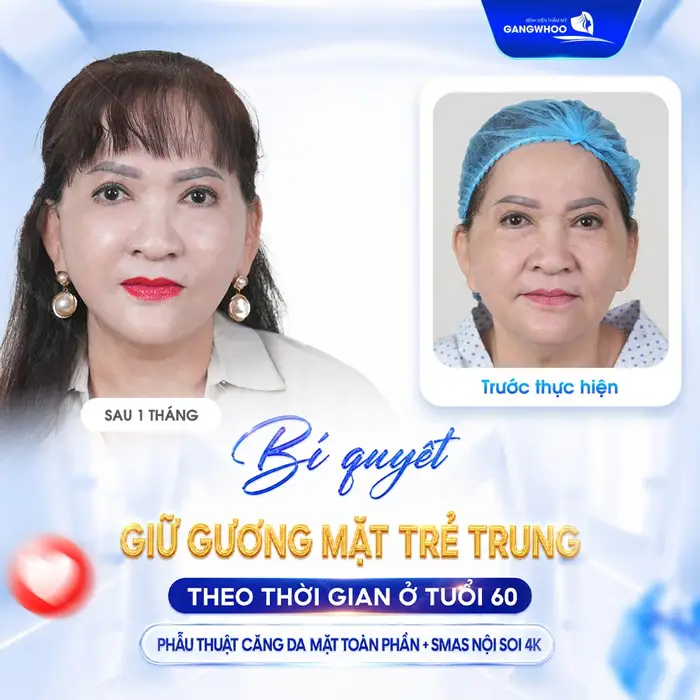 Bí quyết giữ gương mặt trẻ trung theo thời gian ở tuổi 60 với giải pháp làm đẹp hiện đại 