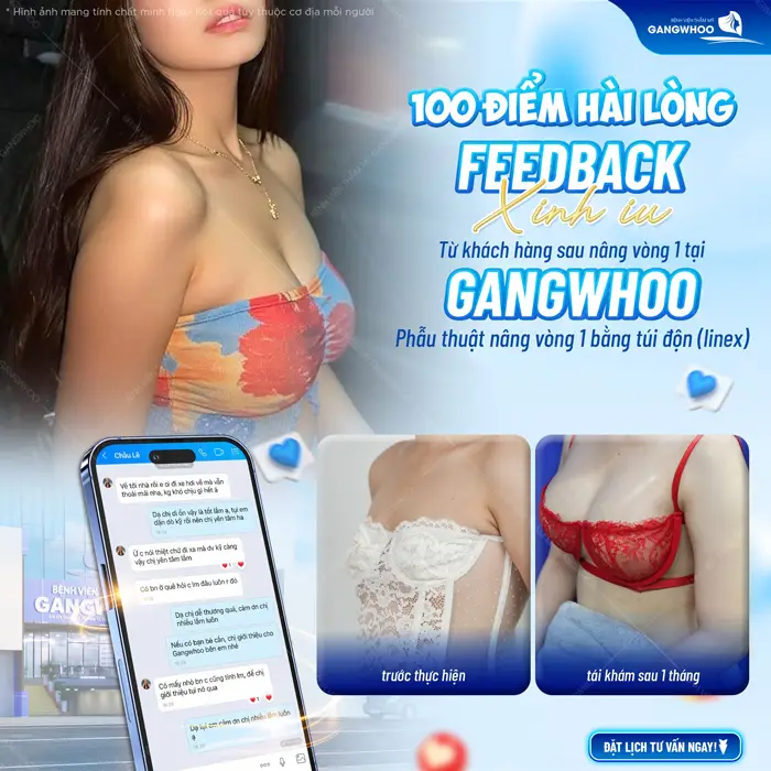 Nâng Ngực Nội Soi Đường Nách Là Gì? 1 Phẫu thuật nâng vòng 1 bằng túi độn ngực đẹp sang, tôn vóc dáng nuột nà cuốn hút