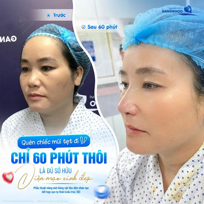 Chỉ sau 60 phút đã sở hữu 1 diện mạo xinh đẹp và rạng rỡ 