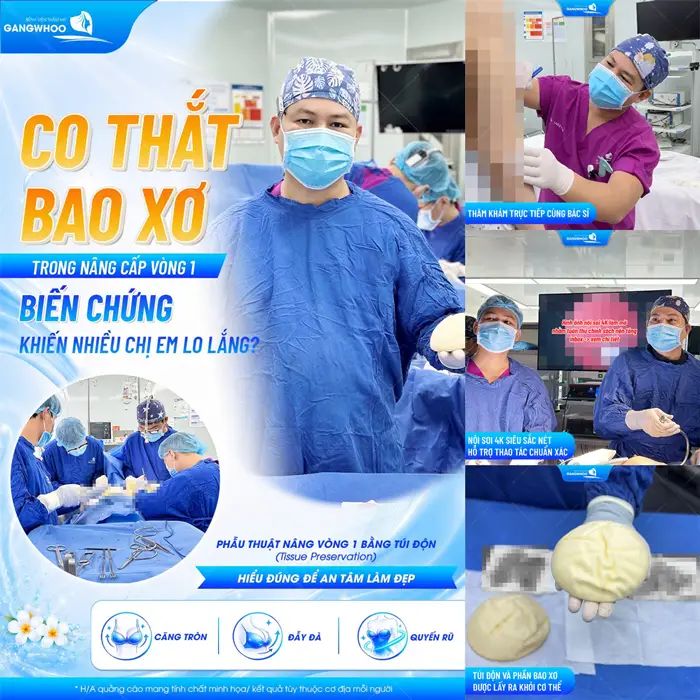 Nâng Ngực Có Nguy Hiểm Không? 5 Tiêu Chí Nâng Ngực An Toàn 2 Co thắt bao xơ trong nâng cấp vòng 1 biến chứng khiến nhiều người lo lắng