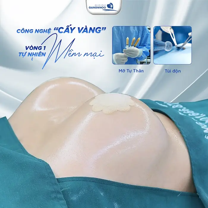 Nâng Ngực Bằng Mỡ Tự Thân: An Toàn Và Hiệu Quả 19 Công nghệ c