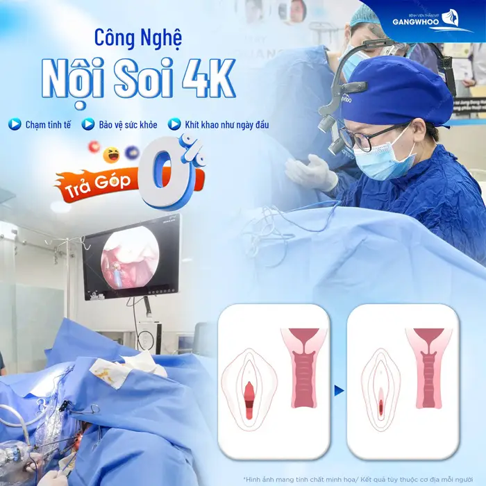 Thu Cơ Âm Đạo: "Cô Bé E Ấp" Cho Chàng Thăng Hoa 5 Thu cơ âm đạo nội soi tinh chỉnh nhẹ nhàng cải thiện độ giãn rộng cho vùng kín thêm khít khao