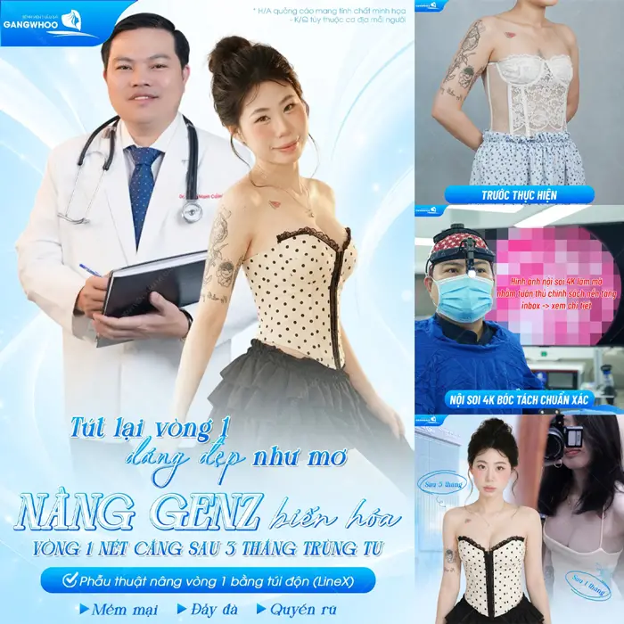 Phẫu Thuật Nội Soi Nâng Ngực (Nâng Ngực Line X) – Vòng 1 Gợi Cảm Chuẩn Tỉ Lệ Vàng 7 Tút lại vòng 1 dáng đẹp như mơ nàng GenZ nét căng sau 5 tháng trùng tu vòng 1 mềm mại và quyến rũ hơn