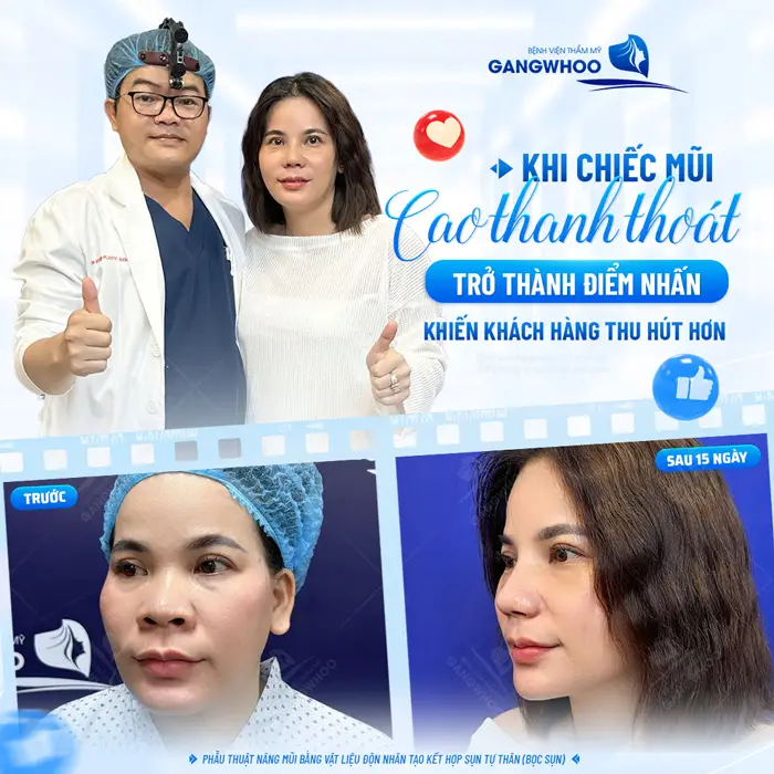 Khi chiếc mũi cao thanh thoát trở thành điểm nhấn sẽ khiến cho khuôn mặt cuốn hút và rạng rỡ hơn