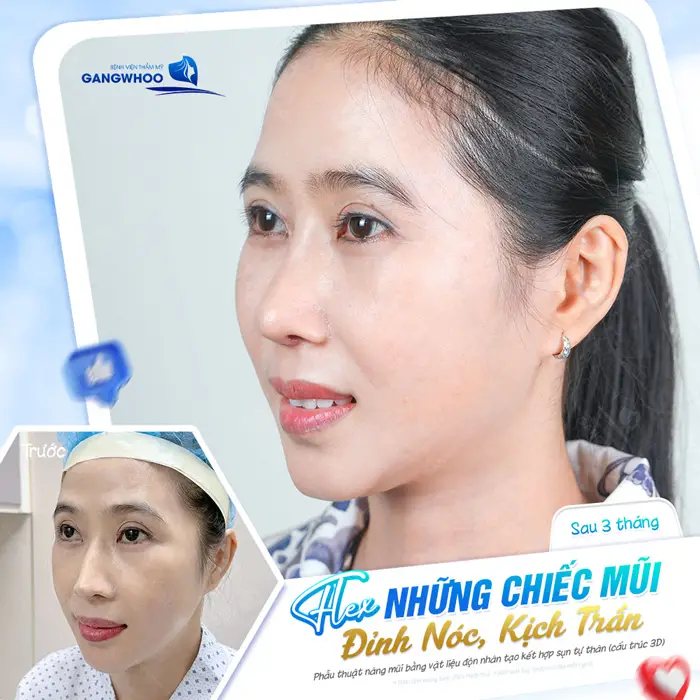 dang mui dep xuat sac tai bvtm gangwhoo 1