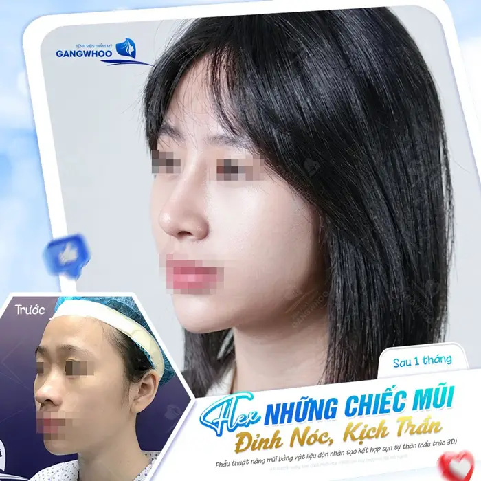 dang mui dep xuat sac tai bvtm gangwhoo 2