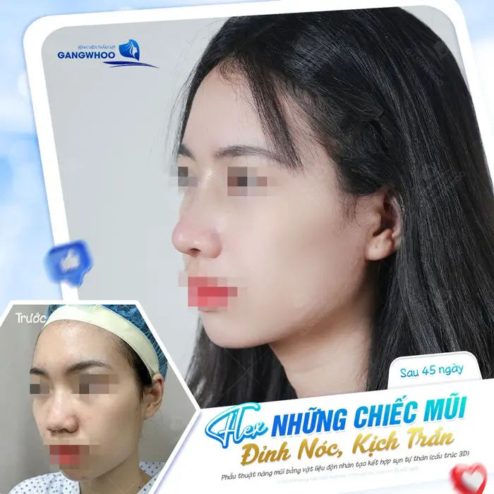 dang mui dep xuat sac tai bvtm gangwhoo 3