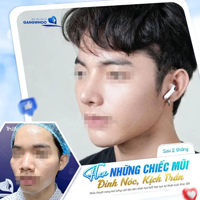 dang mui dep xuat sac tai bvtm gangwhoo 4