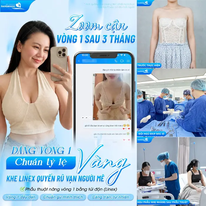 Zoom cận vòng 1 sau 3 tháng dáng vòng 1 chuẩn tỷ lệ vàng khe Line X quyến rũ vạn người mê