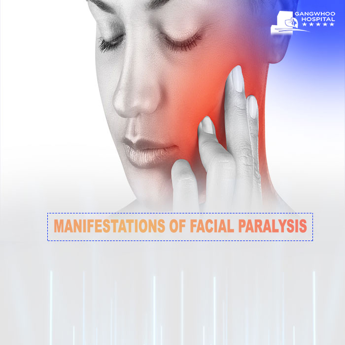 prevent facial paralysis
