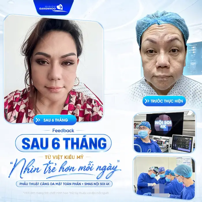 Feedback sau 6 tháng từ Việt Kiều Mỹ nhìn trẻ đẹp hơn mỗi ngày