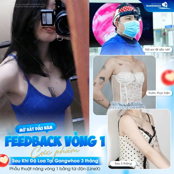 Feedback vòng 1 cực phẩm sau khi "độ loa" tại Gangwhoo sau 3 tháng thực hiện 