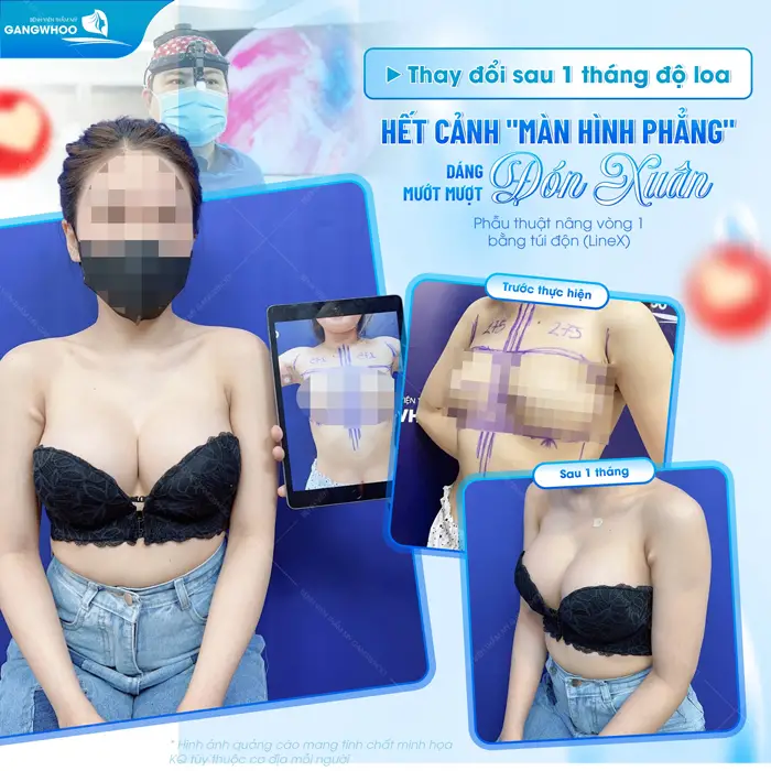 Thay đổi sau 1 thang độ loa hết cảnh "màn hình phẳng" dáng mướt mượt tự tin đón xuân sang xịn đẹp