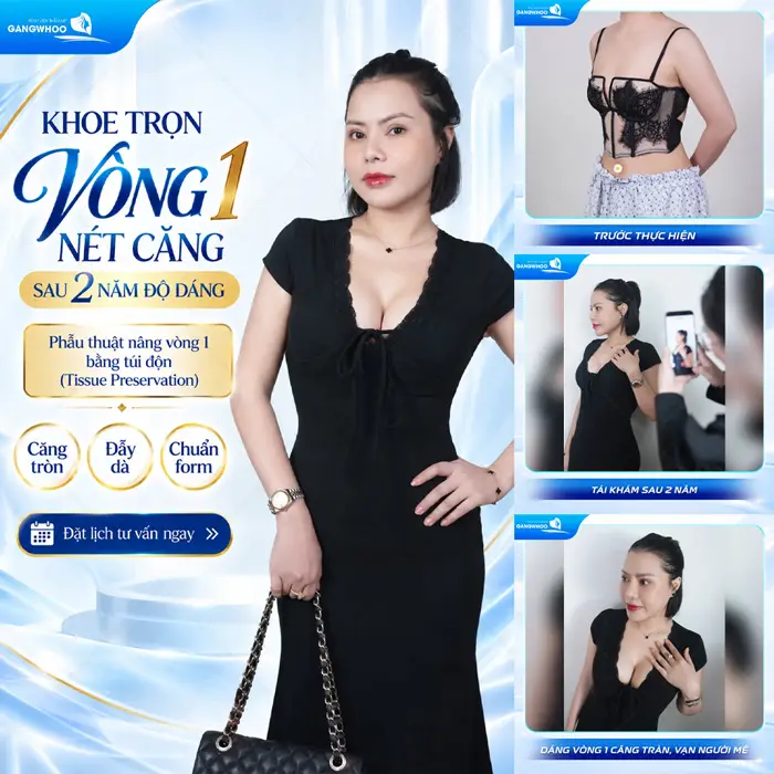 Nâng Ngực Bao Lâu Thì Lành? Cách Chăm Sóc Để Ngực Nhanh Lành 1 Khoe trọn vòng 1 đẹp xuất sắc sau 2 năm trùng tu vòng 1 tại bệnh viện thẩm mỹ Gangwhoo