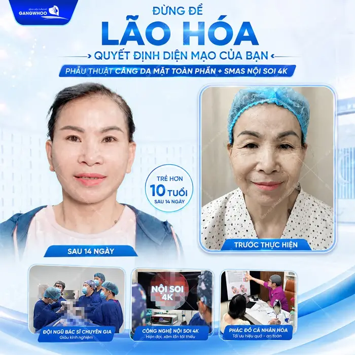 Đừng để lão hóa quyết định diện mạo của bạn trẻ hóa diện mạo hơn 10 tuổi sau 14 ngày gương mặt đã khác biệt