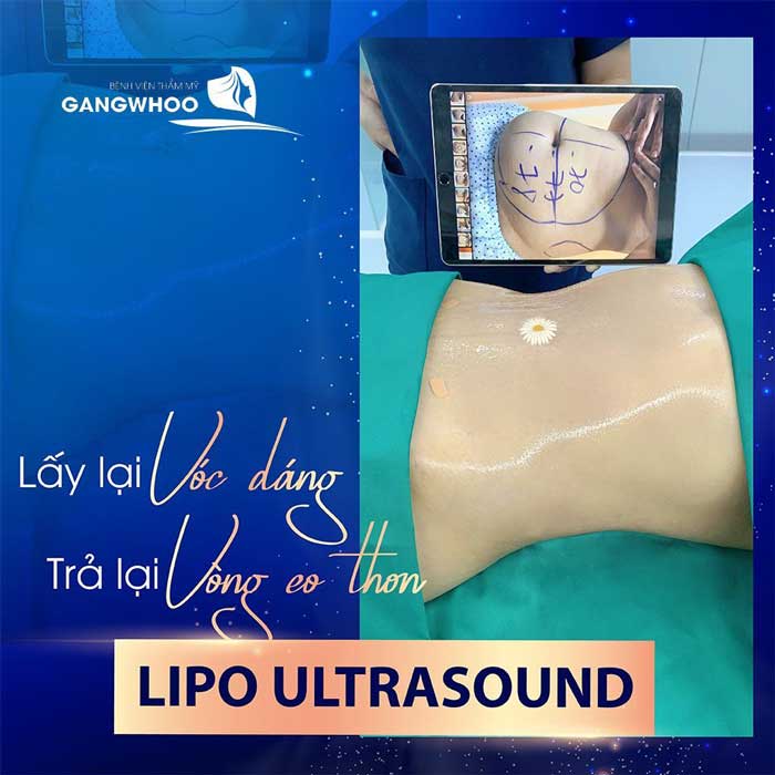 Lipo Ultrasound