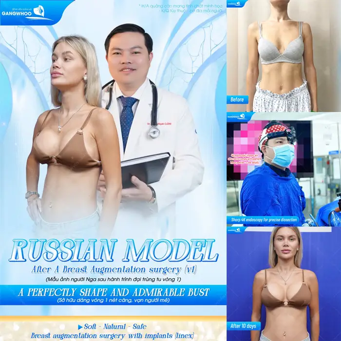 Mẫu Nga tự tin khoe đường cong đẹp xuất sắc sau nâng cấp vòng 1 đã đẹp thăng hạng và đầy quyến rũ