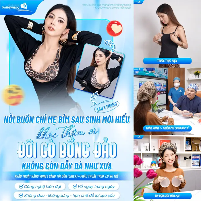 Vòng căng tròn, đẹp quyến rũ sau nâng vòng 1 ứng dụng công nghệ nội soi hiện đại 