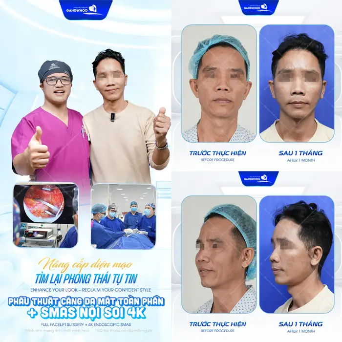 Tìm lại phong thái tự tin sau phẫu thuật căng da mặt toàn phần ứng dụng công nghệ Smas nội soi 4K hiện đại