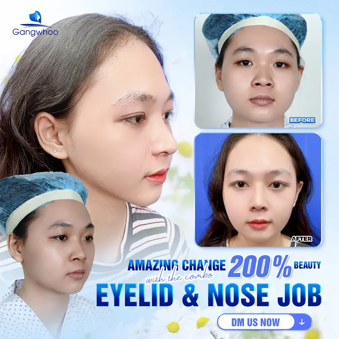 nang mui trung hoa 1