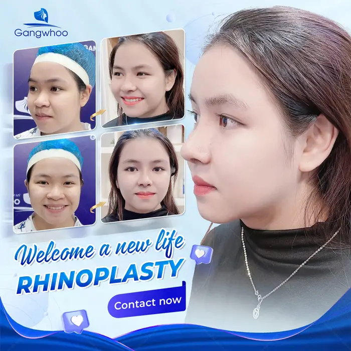 nang mui trung hoa 5