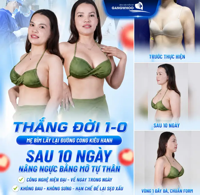 Nâng Ngực Bằng Mỡ Tự Thân Giá Bao Nhiêu? Bảng Giá Năm 2026 3 Thắng đời 1-0 mẹ bỉm lấy lại đường cong kiêu hãnh sau 10 này ânng ngực bằng mỡ tự thân