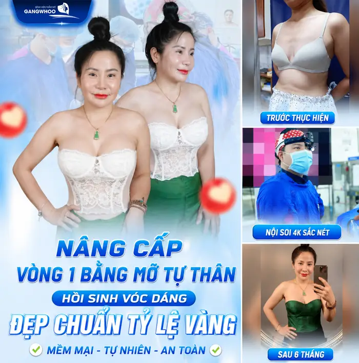 Nâng Ngực Bằng Mỡ Tự Thân Giá Bao Nhiêu? Bảng Giá Năm 2026 4 Nâng cấp vòng 1 bằng mỡ tự thân hồi sinh vóc dáng đẹp chuẩn tỷ lệ vàng