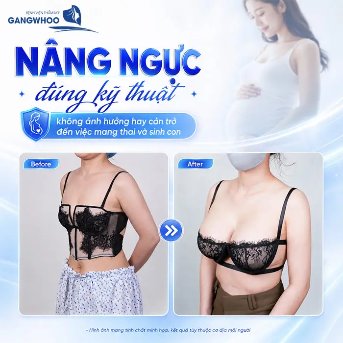 Nâng Ngực Có Sinh Con Được Không? Bao Lâu Được Mang Thai?