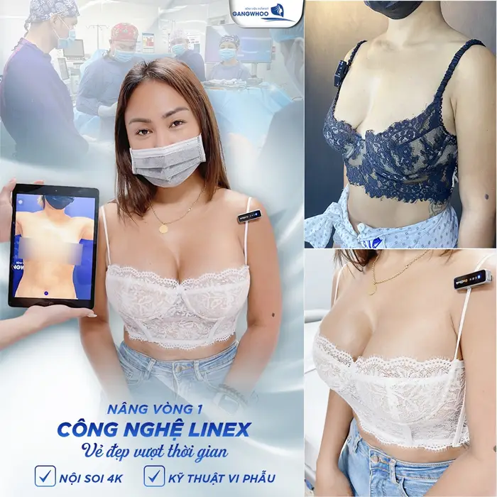 nang nguc cong nghe line