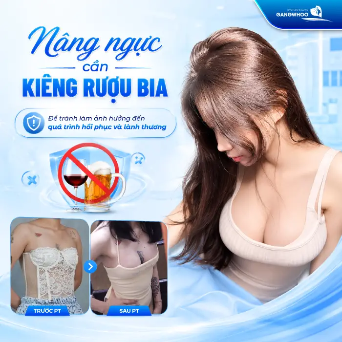Nâng ngực kiêng rượu bia bao lâu? Những hoạt động nên kiêng ra sao?