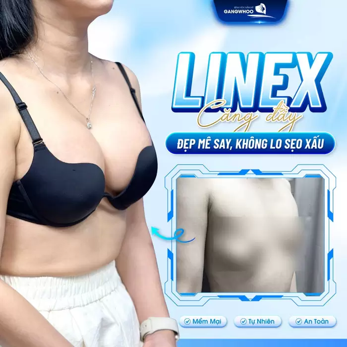 Nâng Ngực Line X – Vòng 1 Gợi Cảm Chuẩn Tỉ Lệ Vàng 4 Nâng ngực Line X đường cong mềm mại, đẹp say mê không lo bị sẹo xấu