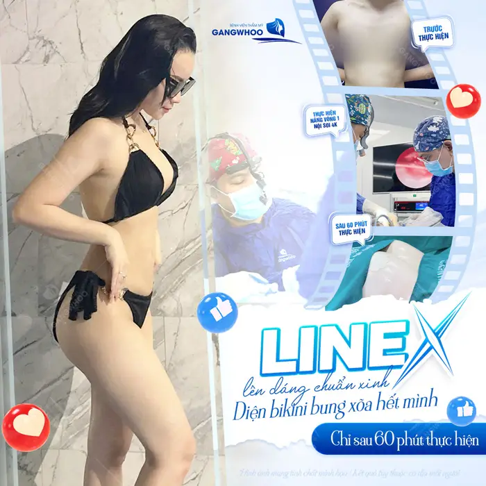 Nâng Ngực Line X – Vòng 1 Gợi Cảm Chuẩn Tỉ Lệ Vàng 1 Vòng 1 đẹp chuẩn Line X lên dáng chuẩn xinh diện bikini cực nuột