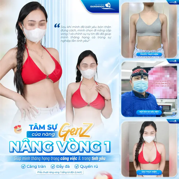 Tâm sự GenZ nâng vòng 1 giúp body thăng hạng, diện mạo thêm tự tin và chuẩn sắc vóc