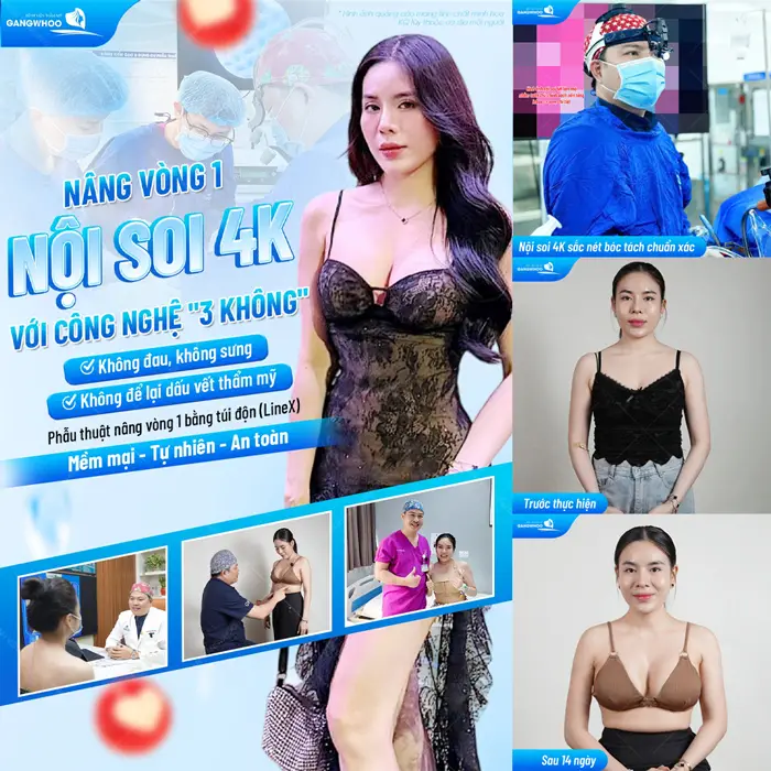 Nâng vòng 1 nội soi với công nghệ hiện đại tự tin sở hữu vòng 1 đẹp xuất sắc và an toàn