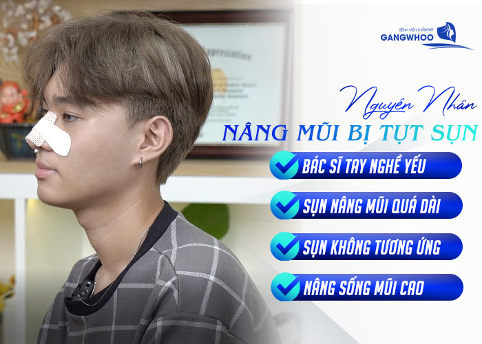 Nâng Mũi Bị Tụt Sụn