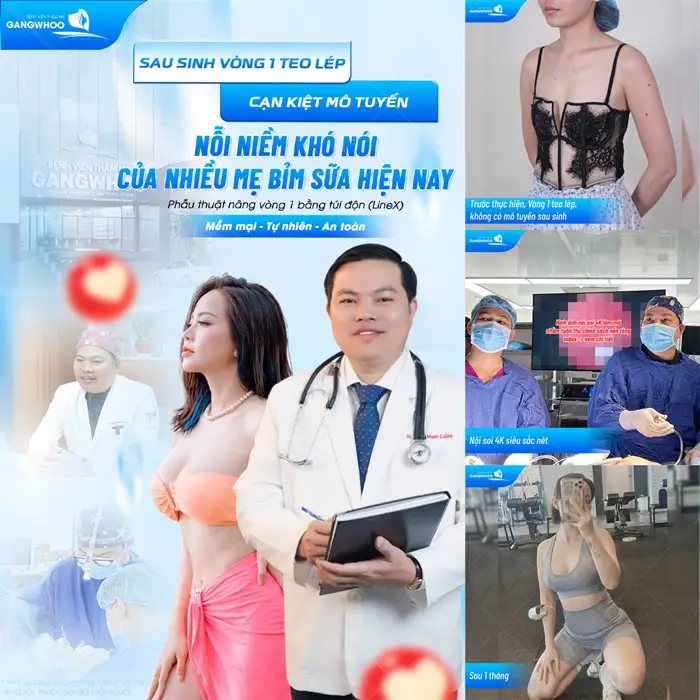 Nâng vòng 1 ứng dụng công nghệ hiện đại mẹ bỉm thoát vòng 1 teo lép mất mô tuyến sau sinh