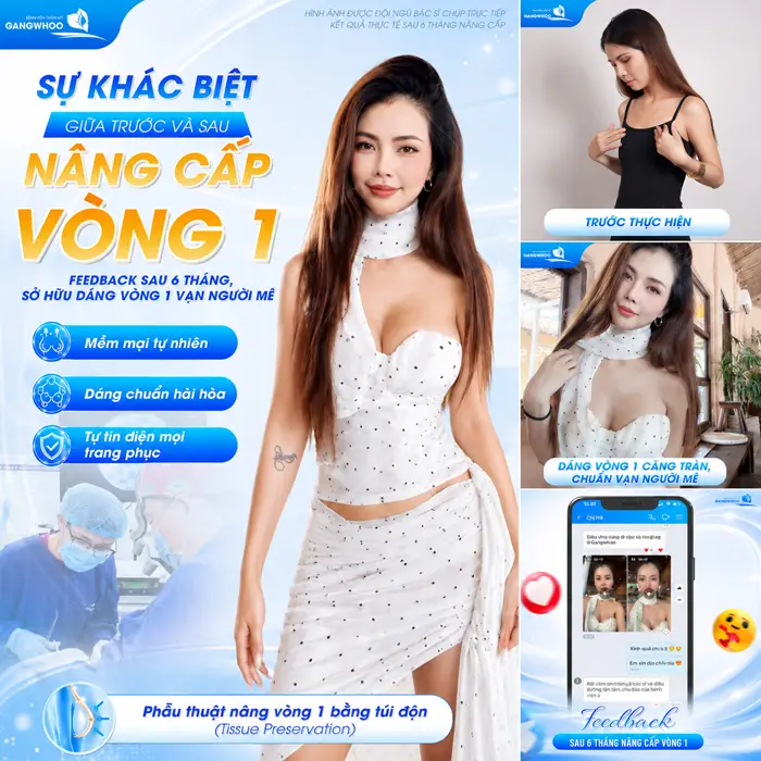 Nâng cấp vòng 1 tại BVTM Gangwhoo kết quả sau 6 tháng sóc vóc đẹp đầy bất ngờ