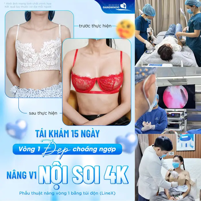 Tái khám sau 15 ngày vòng 1 đẹp cuốn hút, tự tin khoe body đẹp quyến rũ và hấp dẫn ánh nhìn