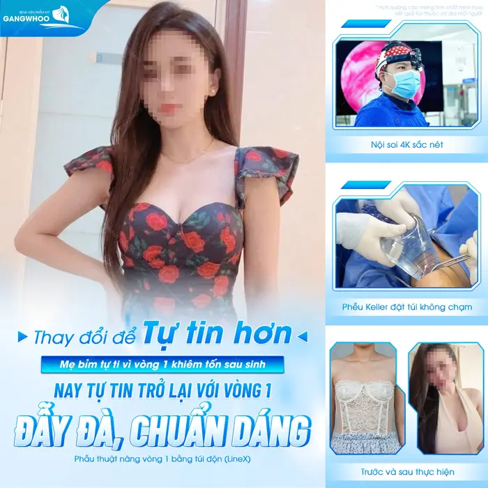 Thay đổi để tự tin hơn mẹ bỉm tự tin trở lại với vòng 1 đẫy đà đẹp chuẩn dáng 